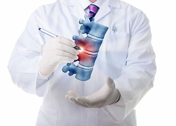 Epidural Injections Los Angeles Pain Specialist 2 - Epidural Injections