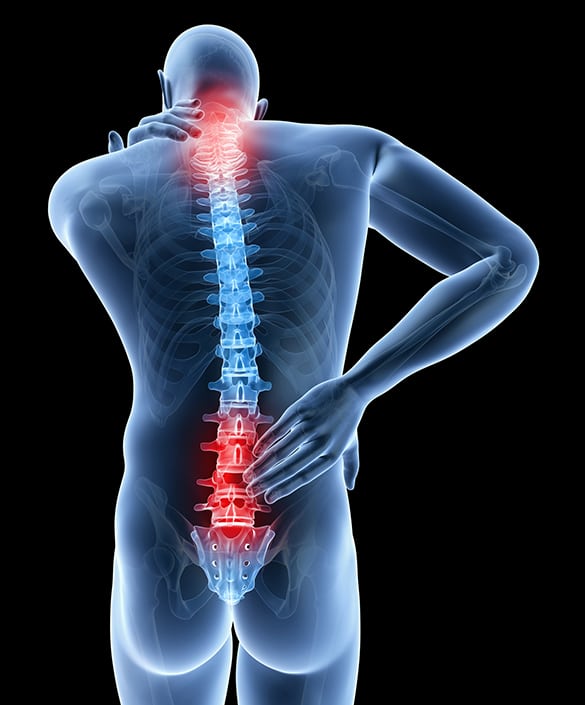 Spinal Stenosis Los Angeles Pain Specialist 2 1 - Spinal Stenosis