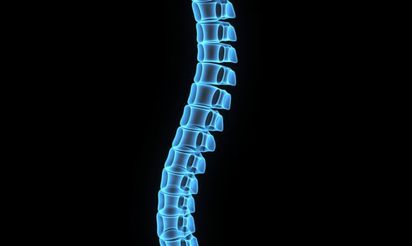 Spinal Stenosis Los Angeles Pain Specialist - Spinal Stenosis