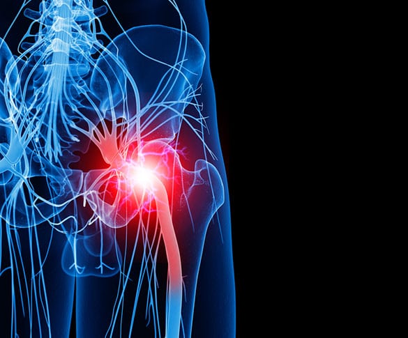 Lumbar Sympathetic Block lumbar sympathetic block los angeles pain associates 2 - Lumbar Sympathetic Block