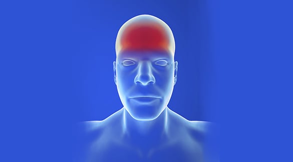 Occipital Neuralgia occipital neuralgia los angeles pain associates 1 - Occipital Neuralgia